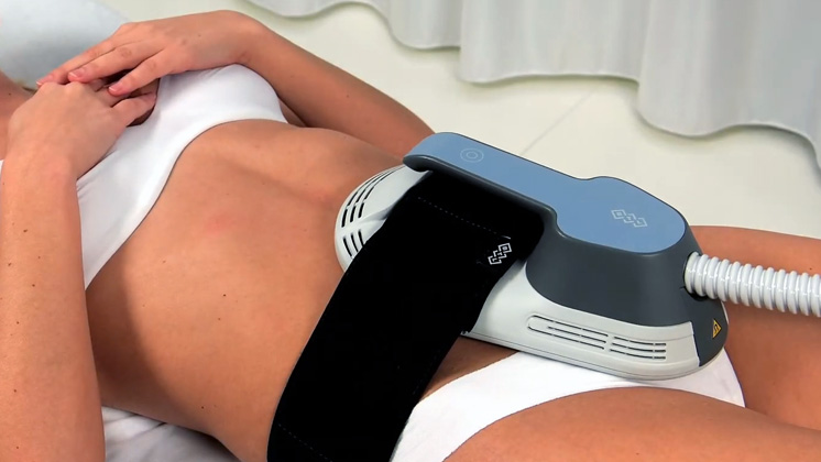 Emsculpt скульптор тела